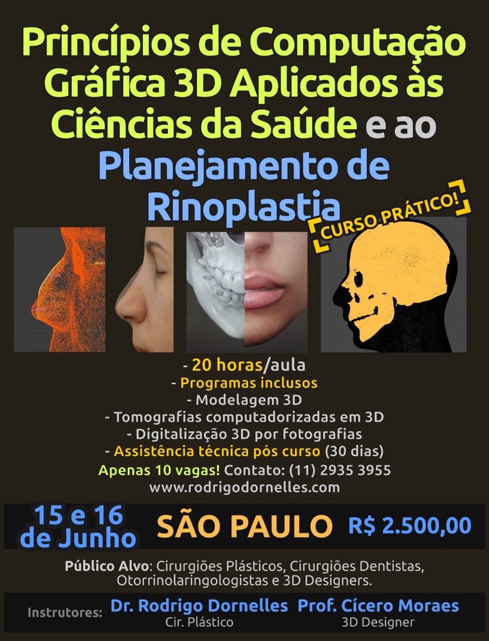 6 - Curso Rinoplastia_Junho_2018